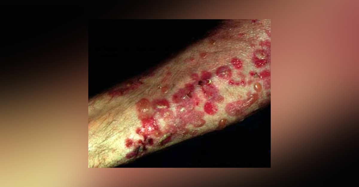 Diagnose The Lesion