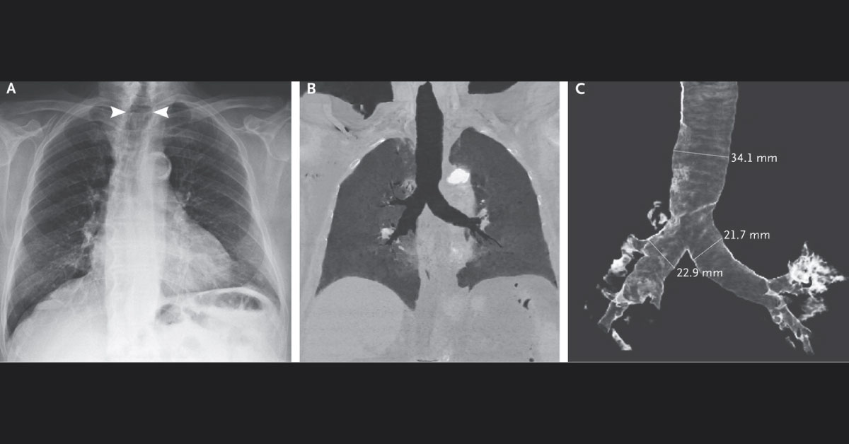 Identify This Condition In An Old Man