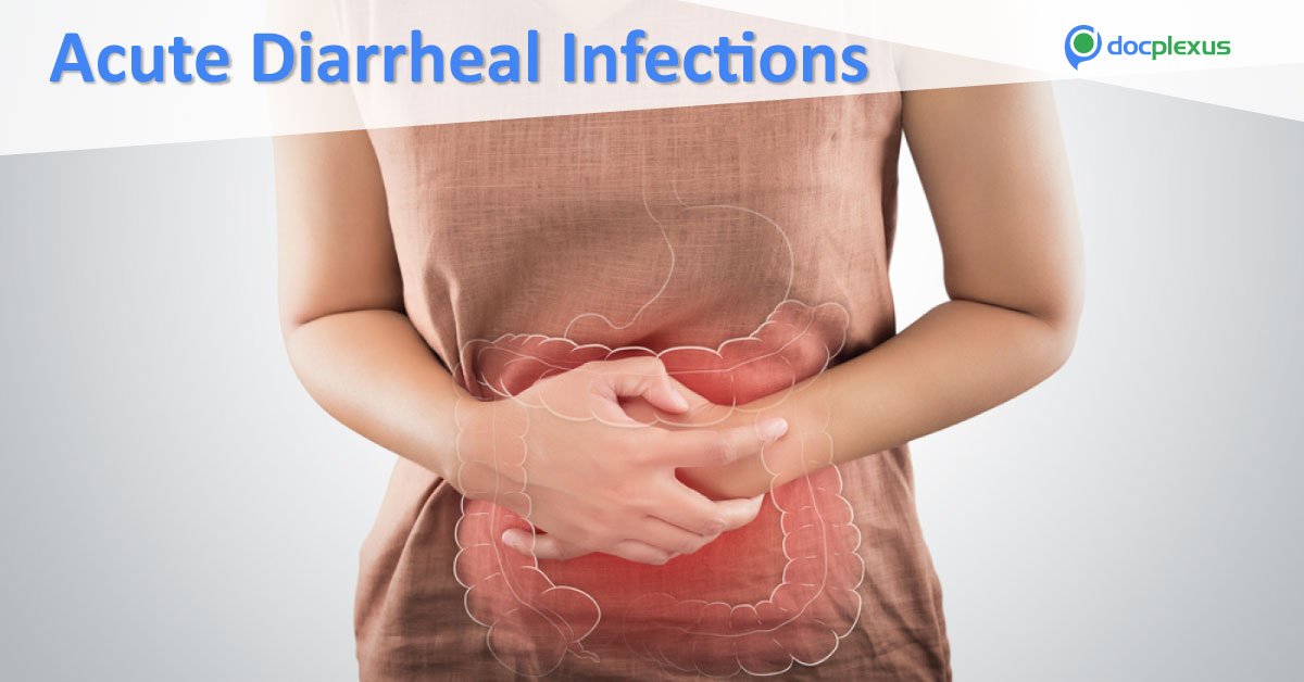 Acute Diarrheal Infections: A Quick Clinical Guide