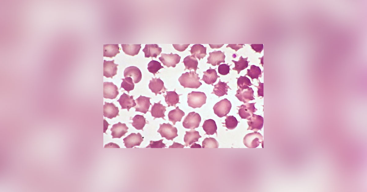 Identify The Underlying Condition