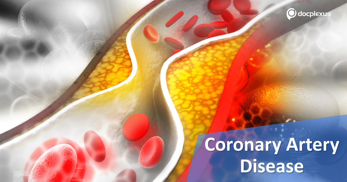 Stable Coronary Artery Disease: ESC Guidance for Treatment