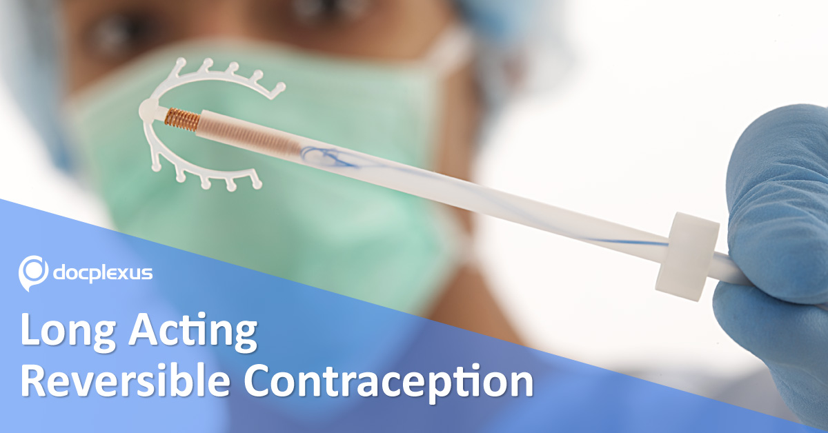 Long Acting Reversible Contraceptives, Clinical Recommendations