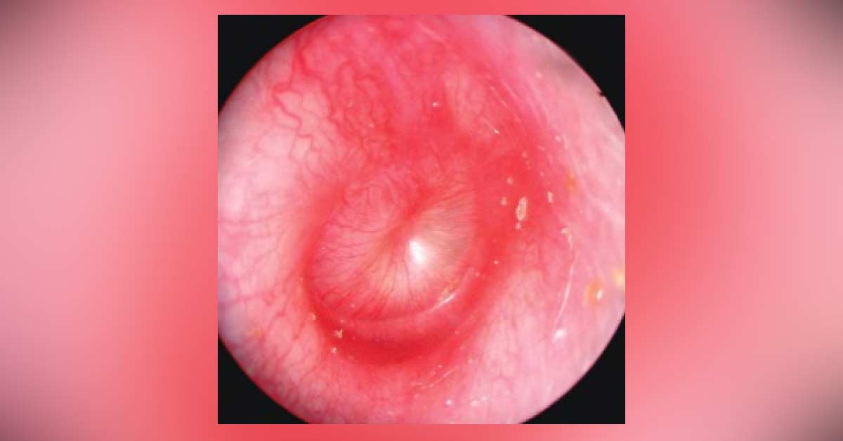 Resolve The Endoscopic Finding