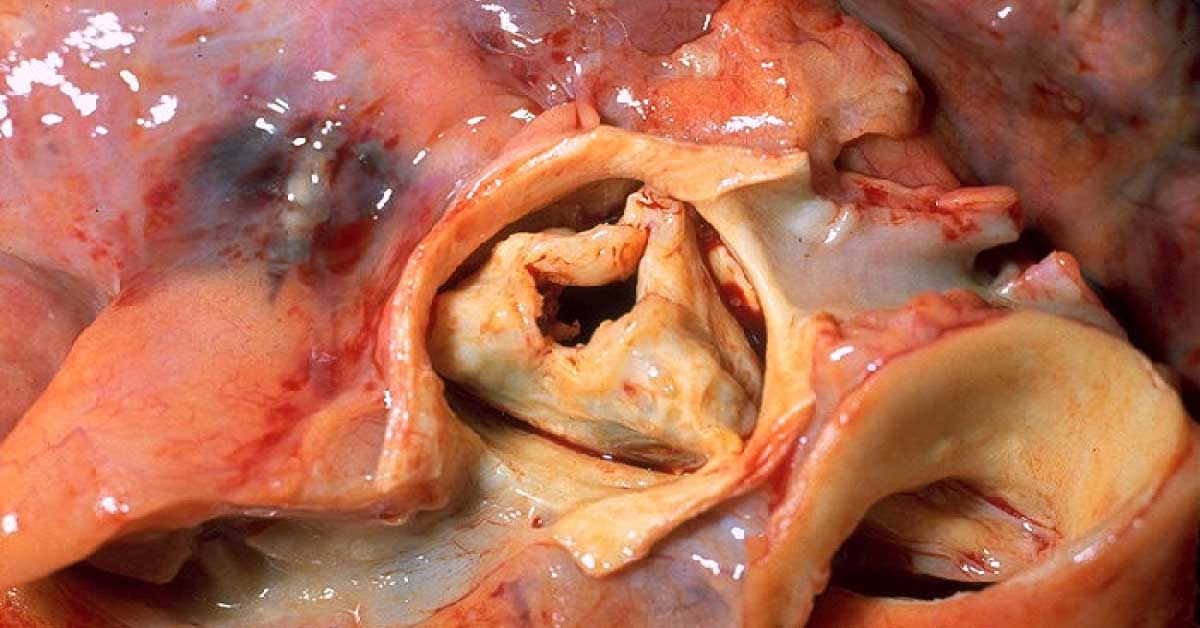 Image Based Diagnosis