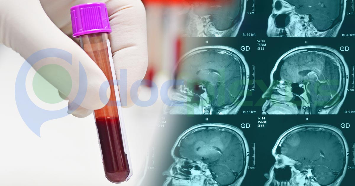 Evaluating New Diagnostic Tests