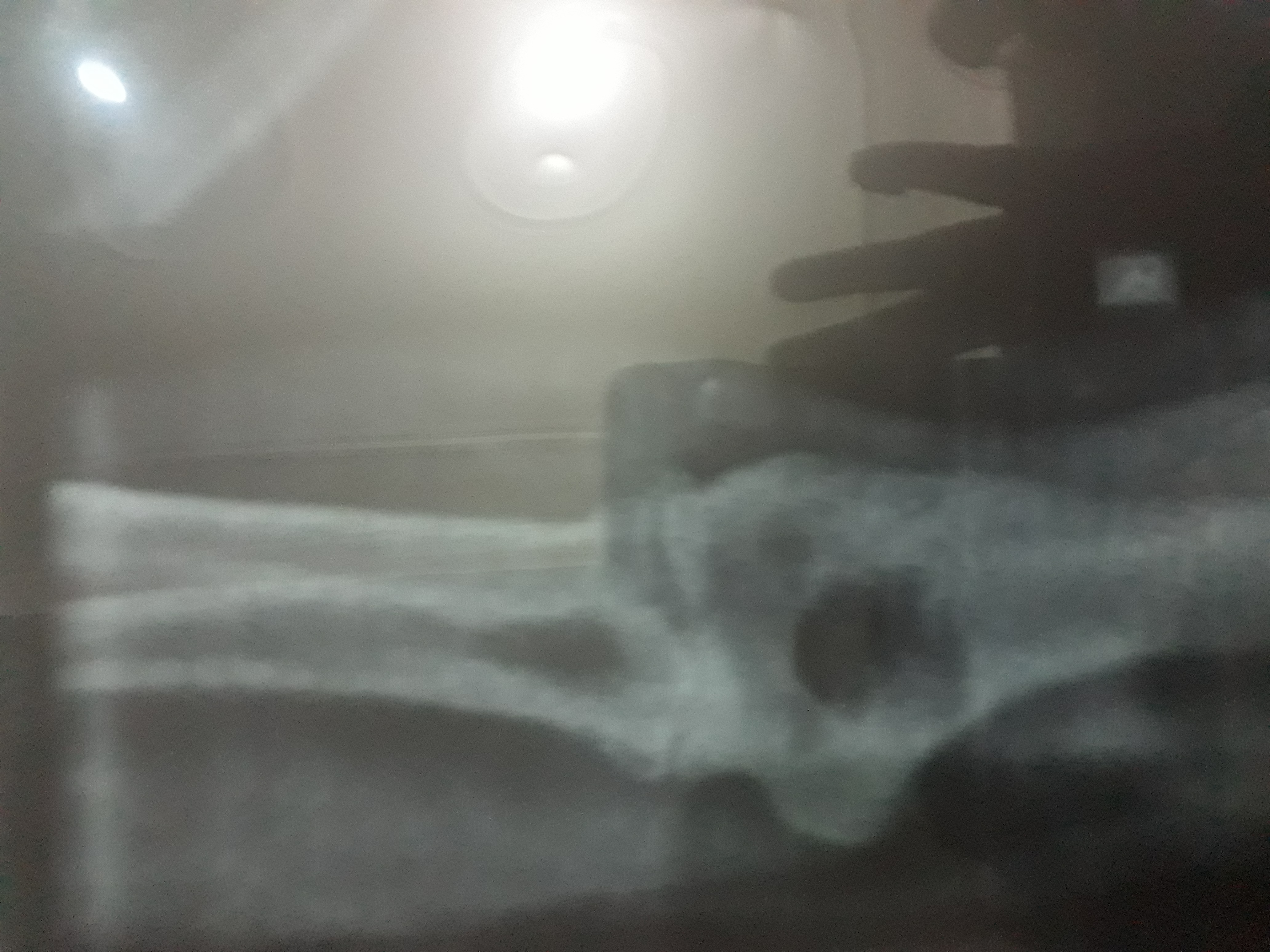 Acute Severe Pain With Muscles Contraction Of Elbow Joint