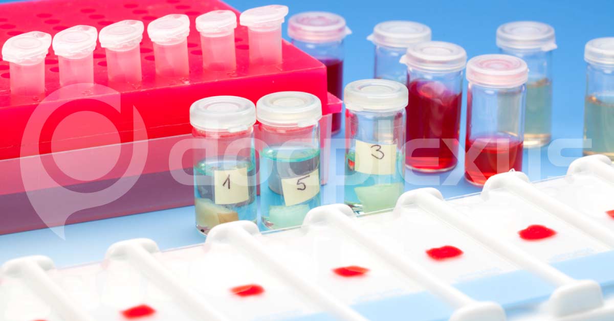 Diagnosing Bladder Cancer By Liquid Biopsies