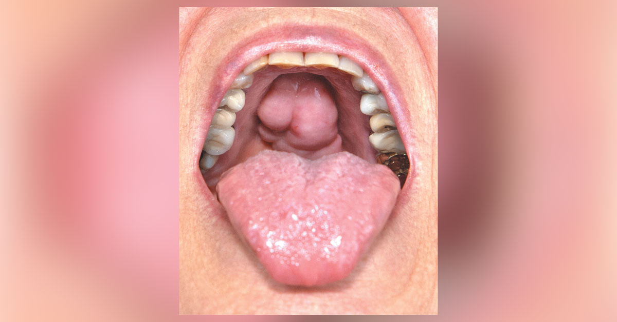 Identify This Condition