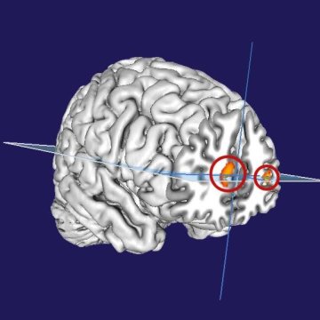 Social Media Engagements Does Not Deteriorate Mental Health