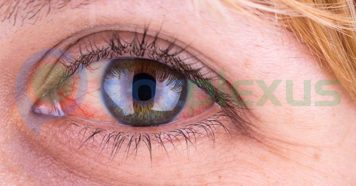 New Device For Treating Dry-Eye Syndrome