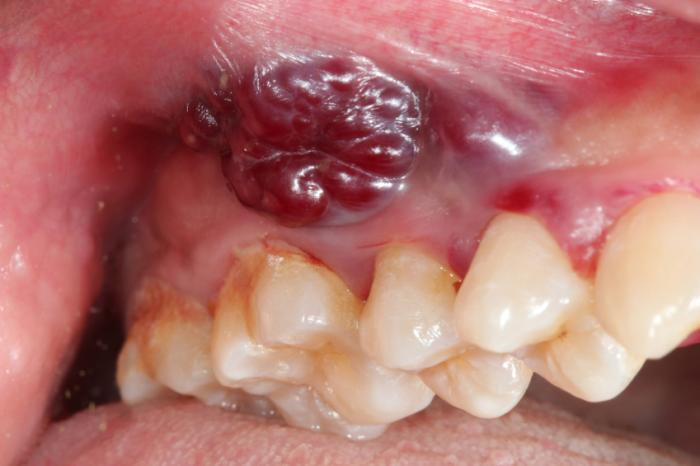 Oral Spot Diagnosis