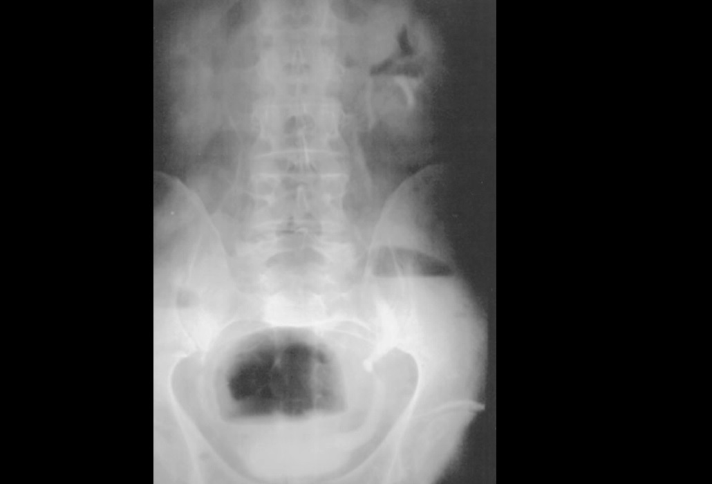 Urology Spot Diagnosis