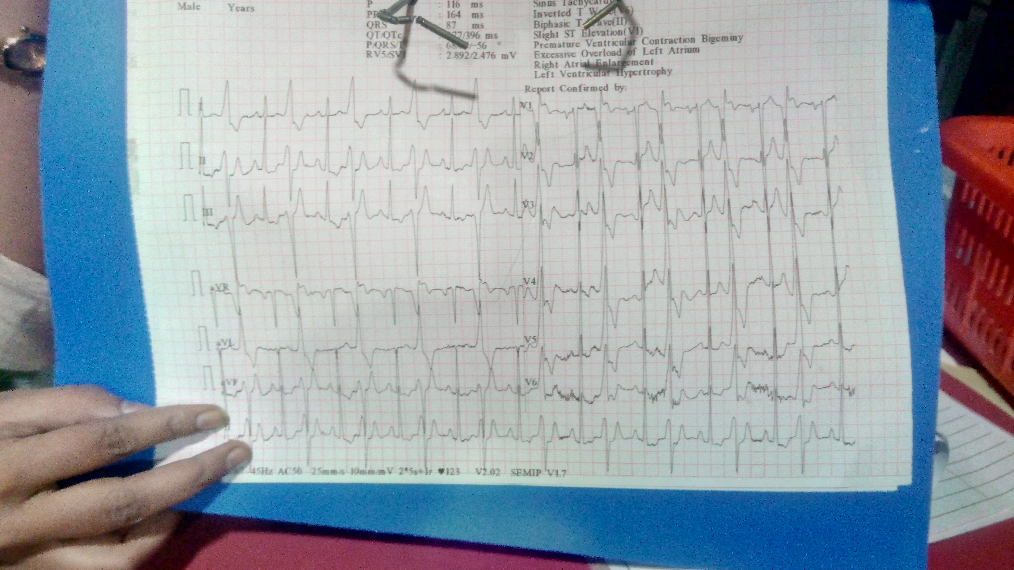 Acute Hypertensive Crisis In 65 Year Old