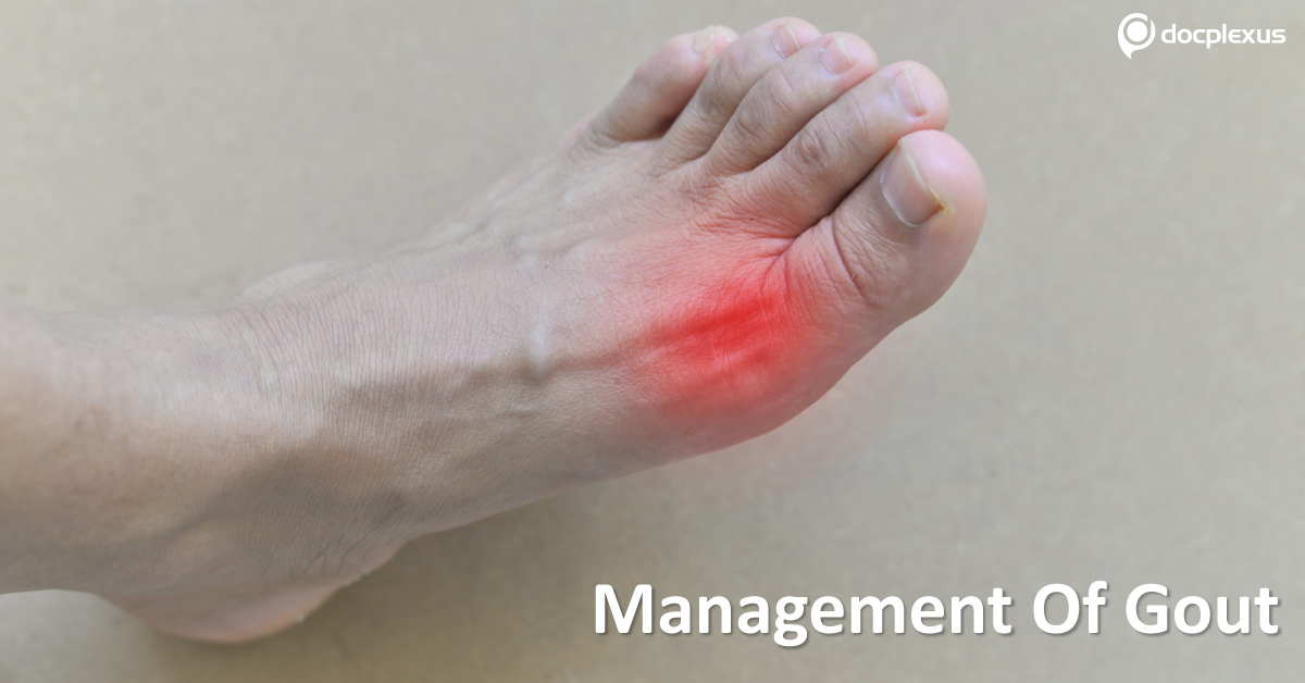 Gout, Treatment Recommendations