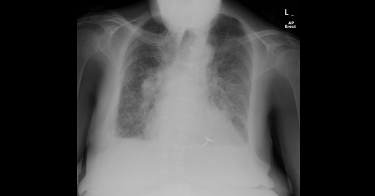 What Does The X-Ray Reveal?