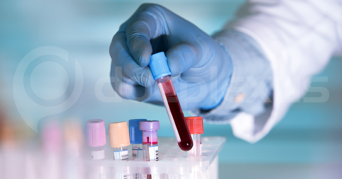 New Test To Detect Recurrence Of Melanoma