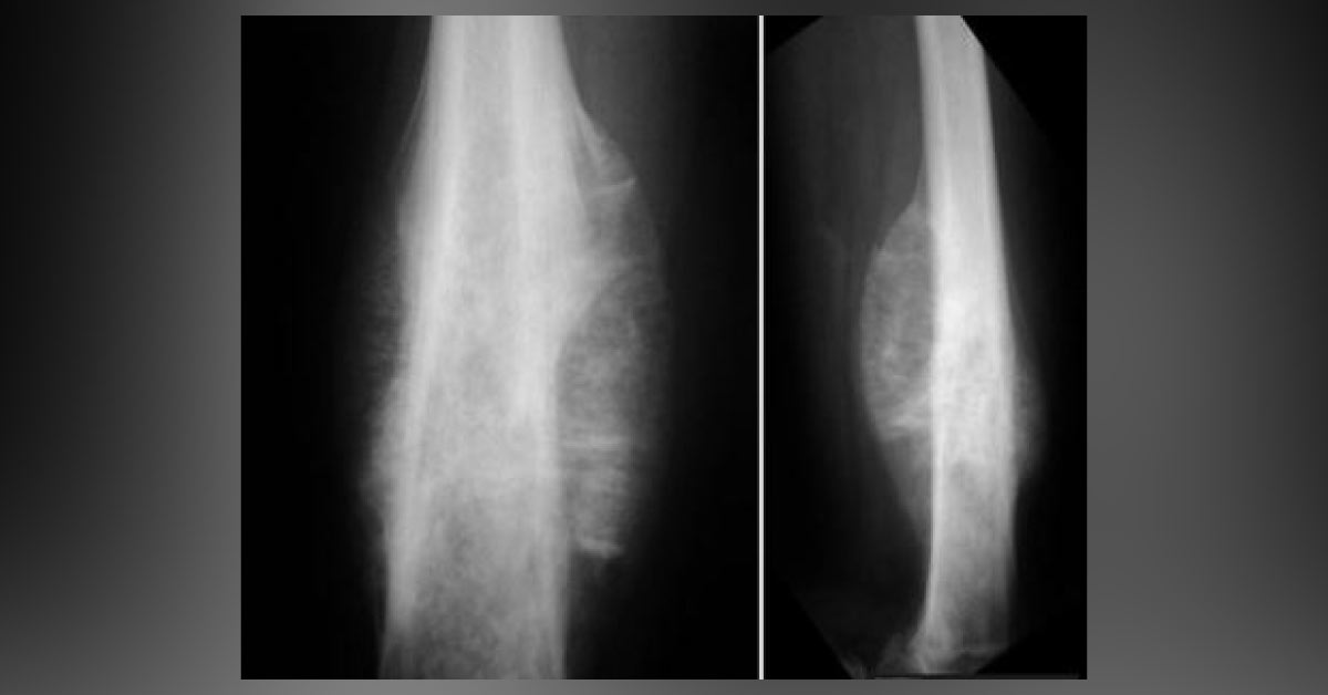 Identify This Condition