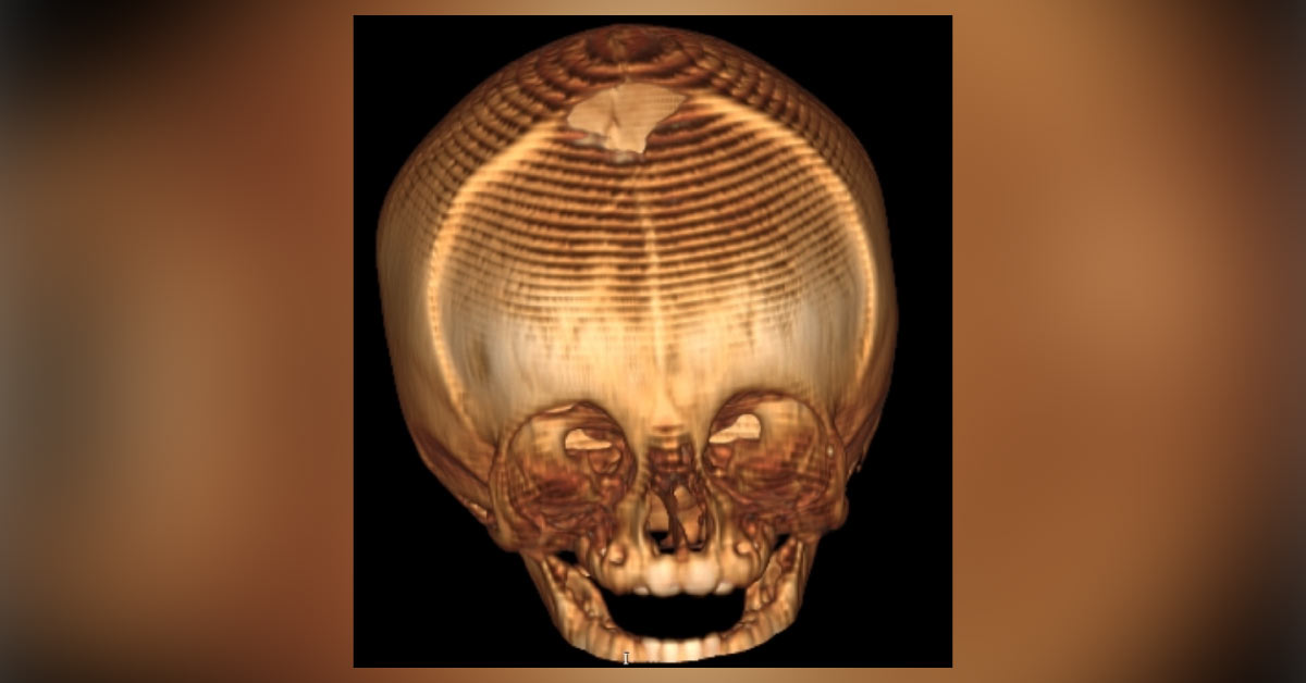 Identify The Abnormality