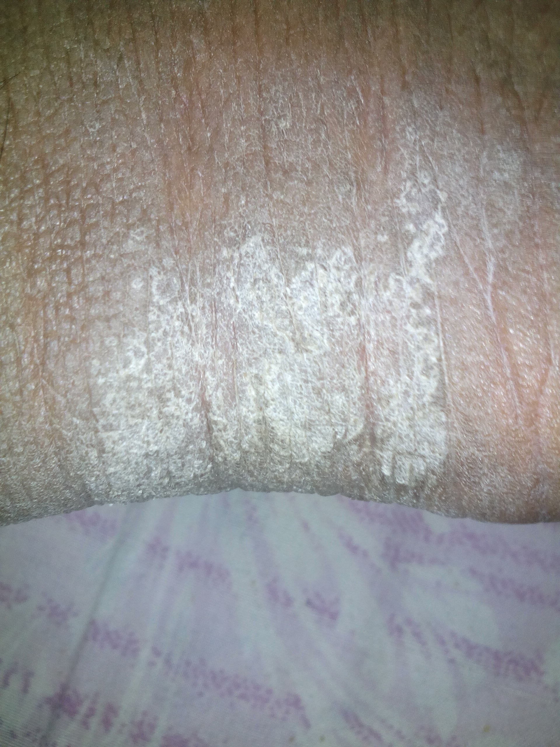 Diagnose The Derma Condition
