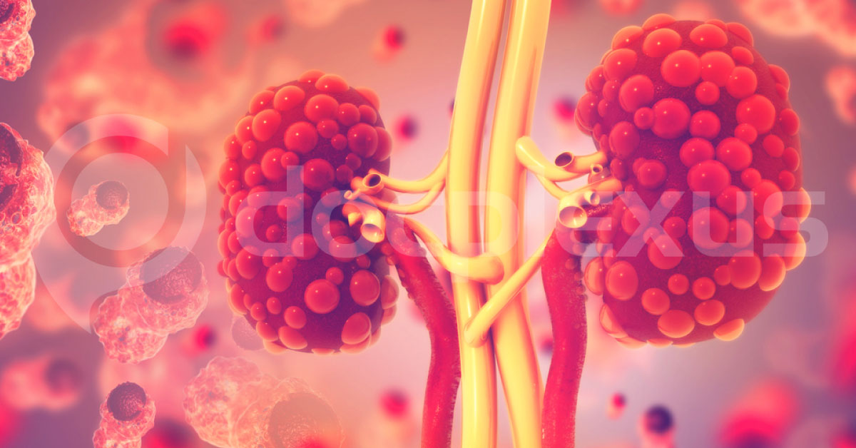 Renal Cell Carcinoma: Guidelines by European Association of Urology