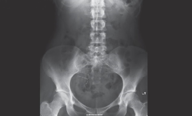 Give Your Diagnosis