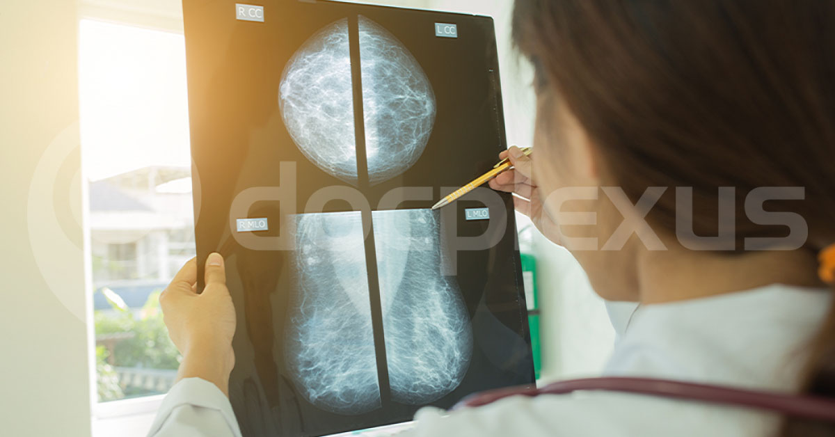 Diagnosing Breast Cancer, What Is Better MRI Or Mammography?