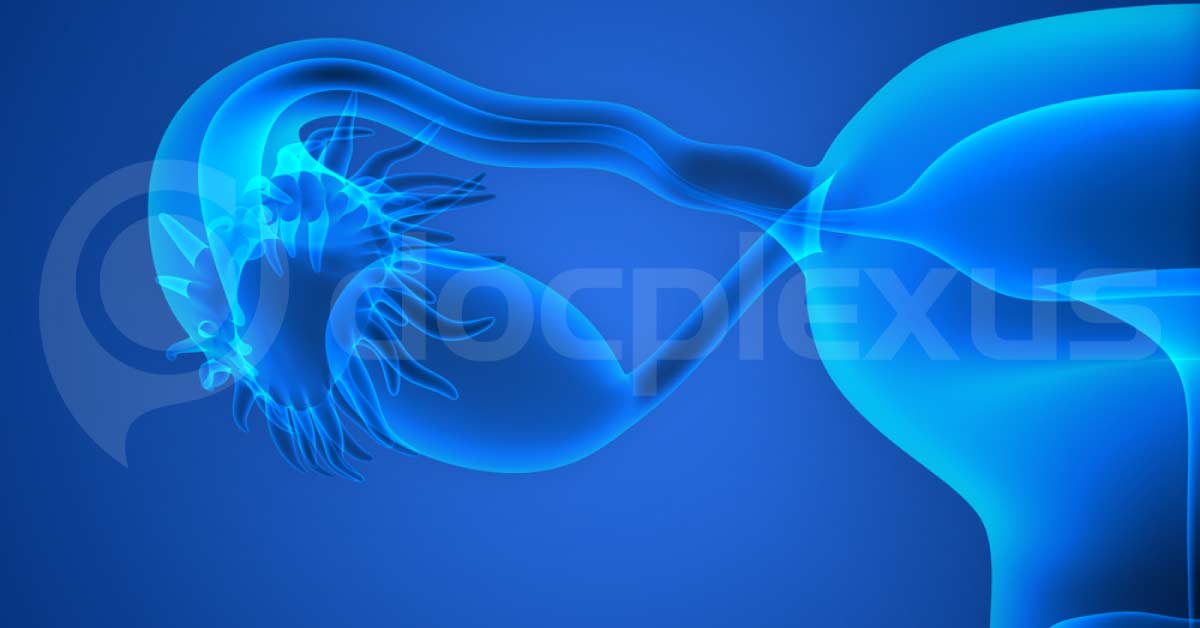 Artificial Ovary Prototype, Is It The Future Of Ovary Transplant?