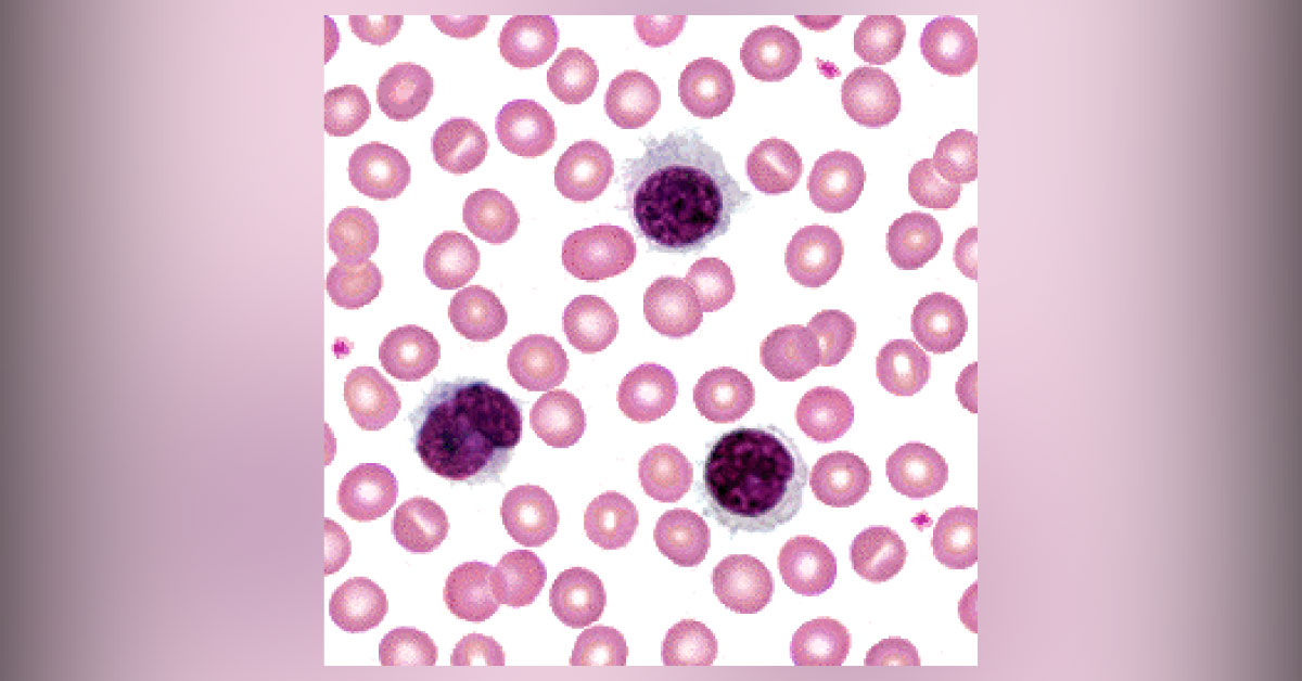 Identify This Condition