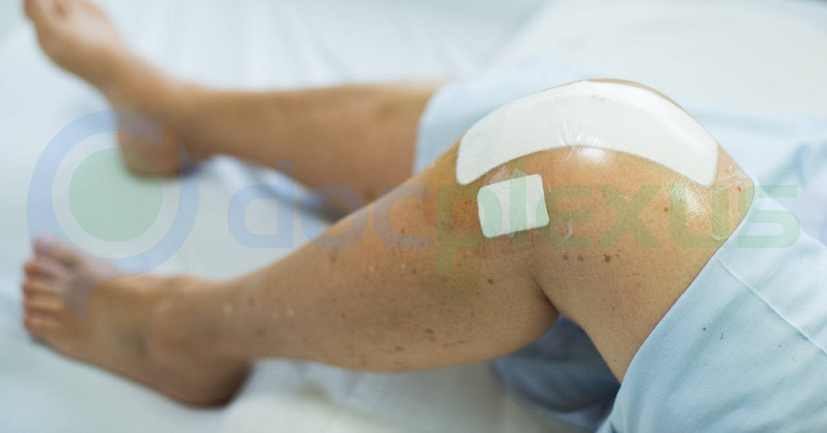 Absolute Diagnostic Measure To Attempt Knee Replacement, X-rays Or Pain: A Sufficient Criteria?