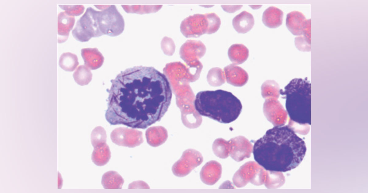 Diagnose The Underlying Condition