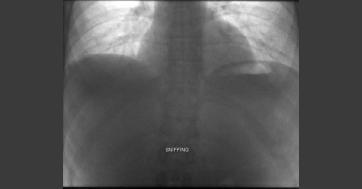 Identify The Abnormality?