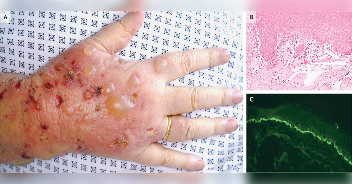 Identify This Condition In An Old Woman