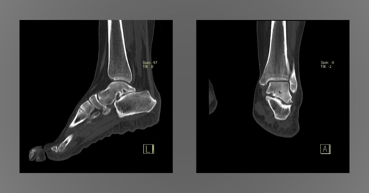 Spot The Diagnosis
