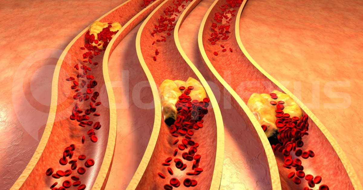 Molecular Explanation Of Saturated Fat's Bad Effect On Our Health