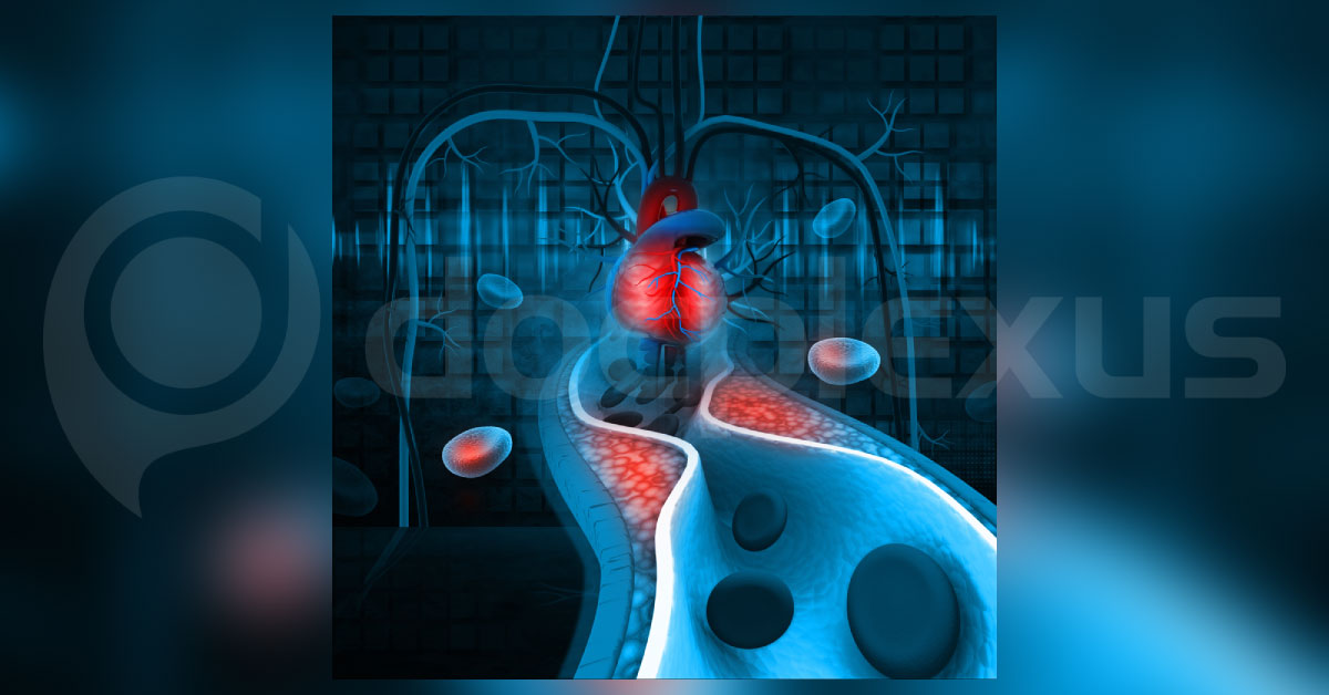 Cardiovascular Risk Assessment Before Non Cardiac Surgery