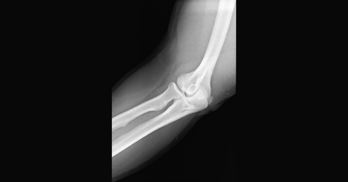 Spot The Diagnosis