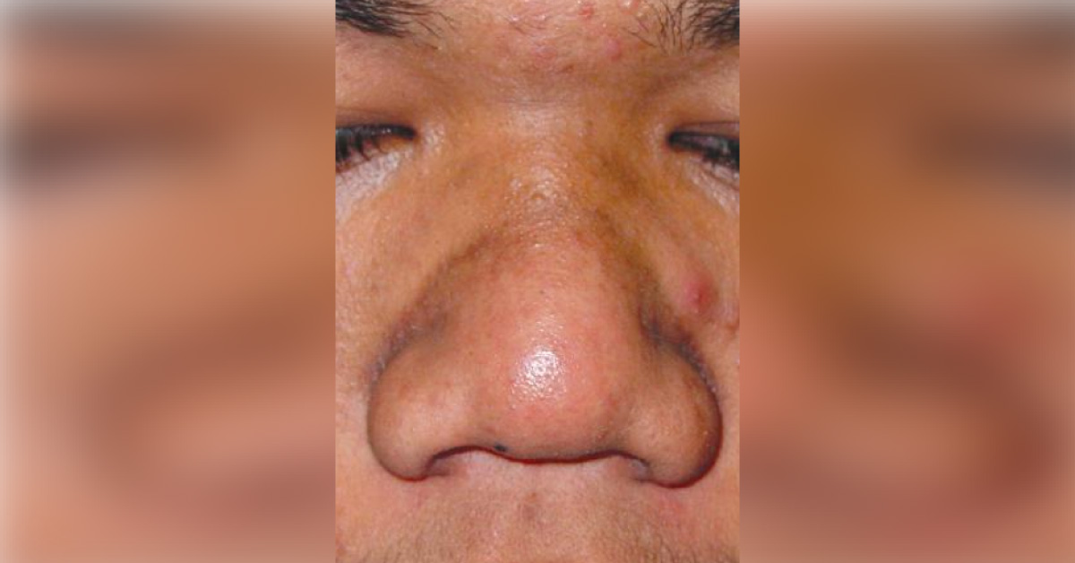 What Are These Nose Marks?