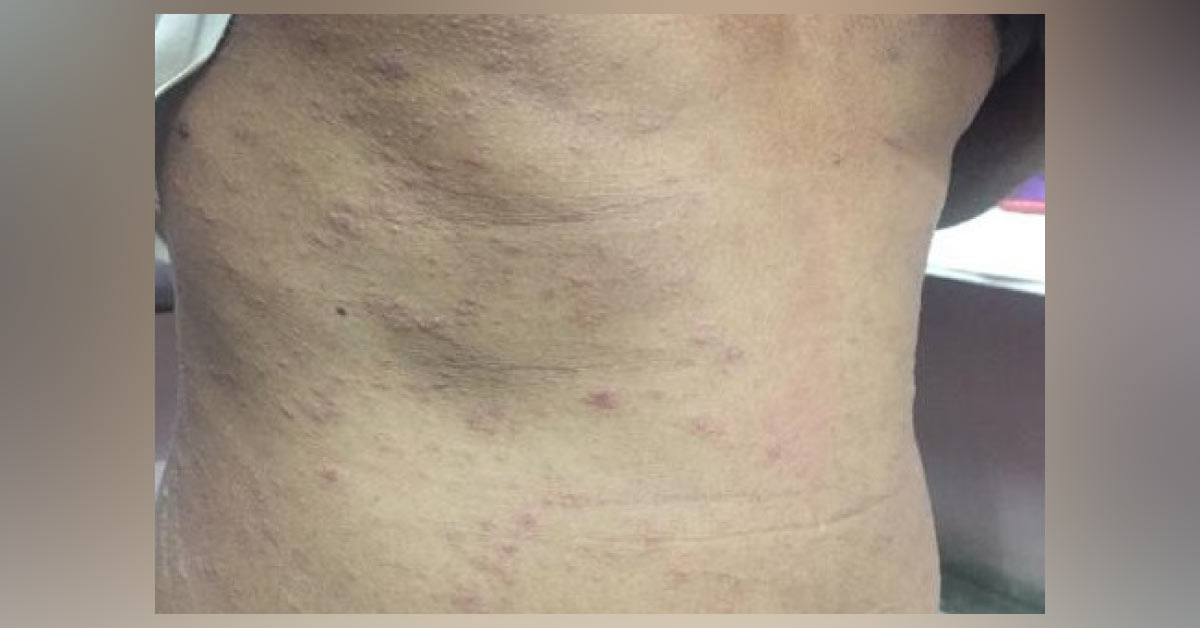 Identify The Skin Condition
