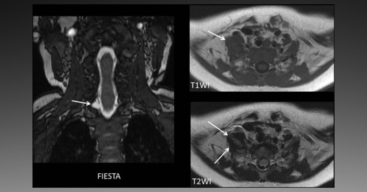 Which Differentials Do You Suggest?