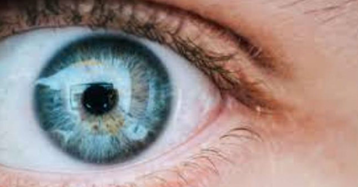 Brief Review On Ocular Manifestations Of Cystinosis