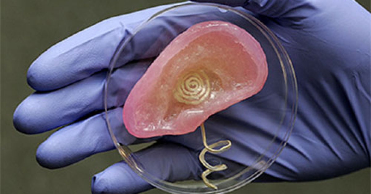 3D Printed Ear Implants Can Improve Treatment For Hearing Loss