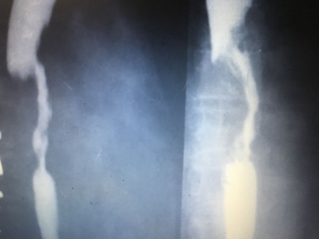 Diagnose This Condition