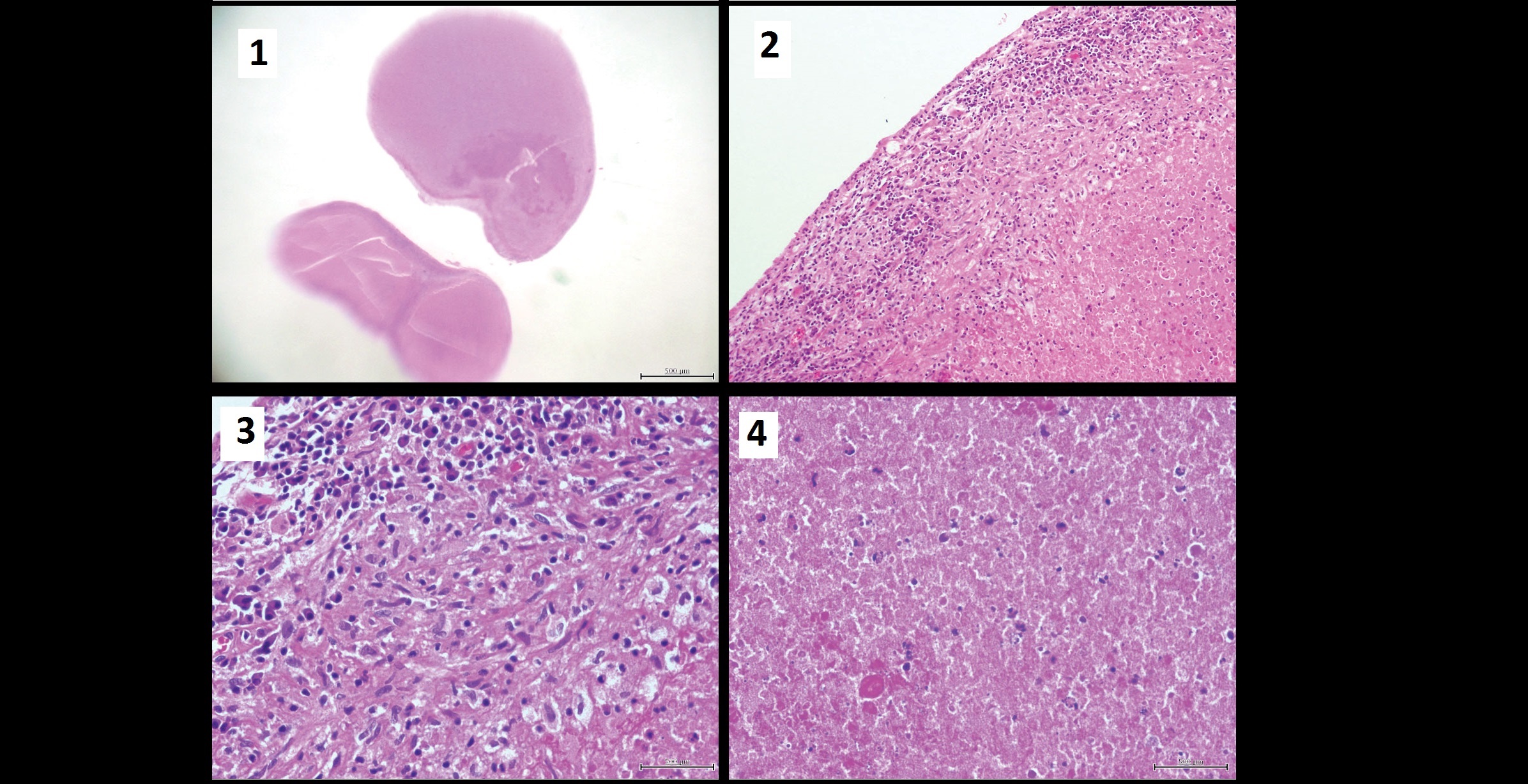 Interpret These Pathological Images