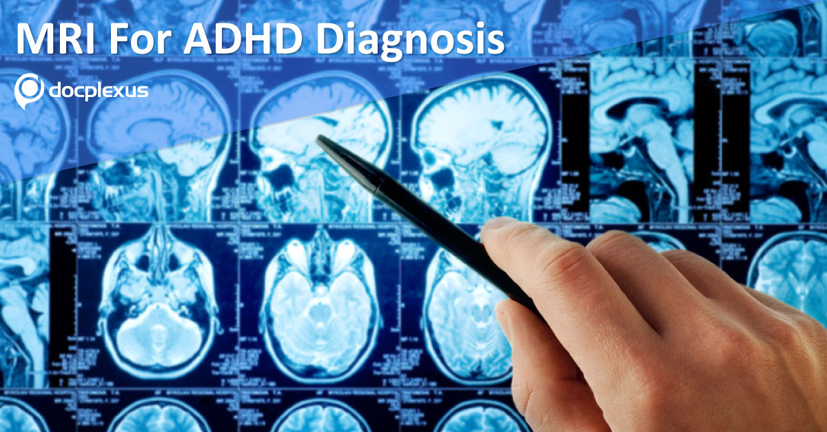 Diagnosis And Classification Of ADHD With MRI Scans