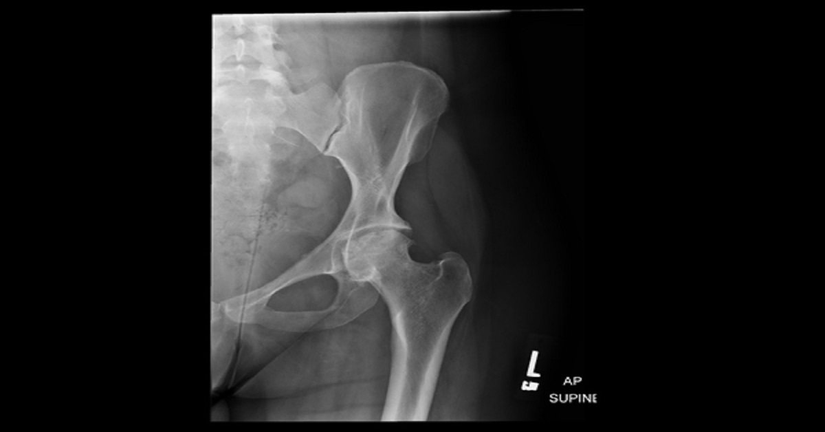 How Will You Manage This Patient?