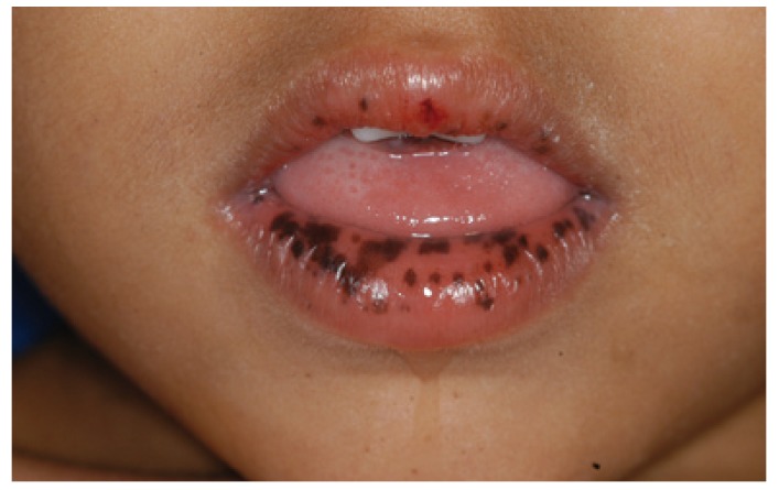 Image Based Diagnosis