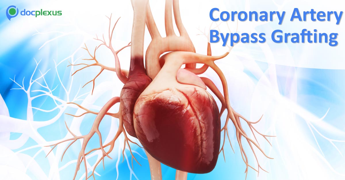 Which CABG Technique Better: On Pump Or Off Pump?
