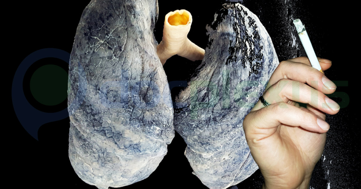 Should India Ban Tobacco Completely