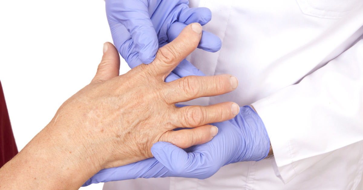 Treating Rheumatoid Arthritis Patients, What Do Orthopedicians Think?