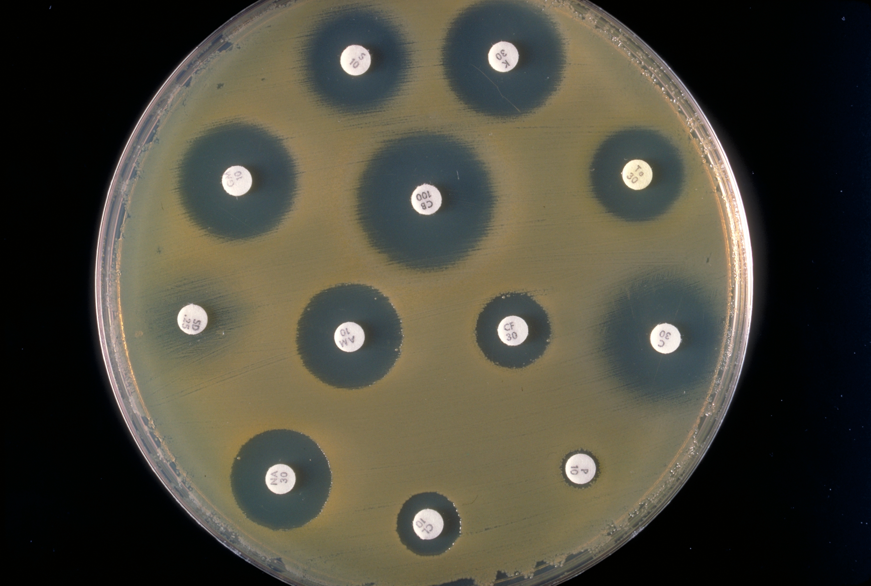 New Mechanism Of Antibiotic Resistance Revealed